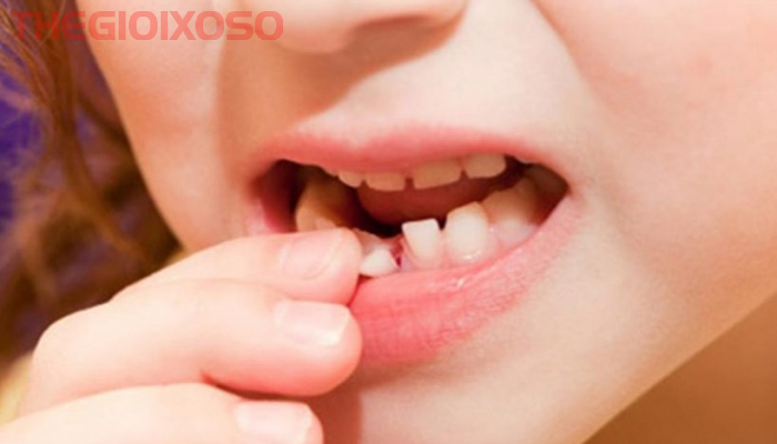 Giải Mã Ý Nghĩa Giấc Mơ Thấy Rụng Răng - Mơ Rụng Răng Là Điềm Tốt Hay Xấu?